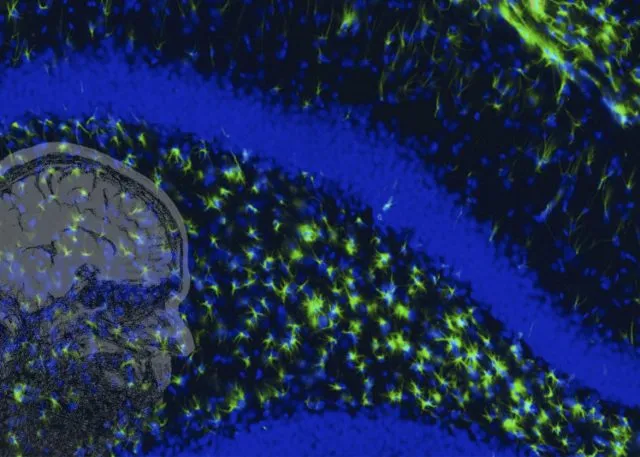 A close of a brain and cells