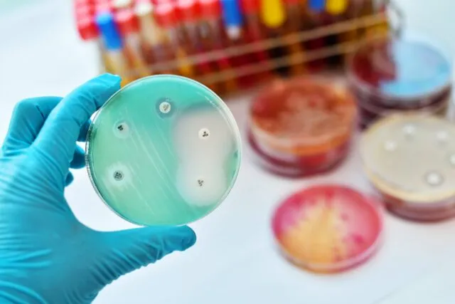 Antimicrobial,Susceptibility,Testing,In,Petri,Dish
